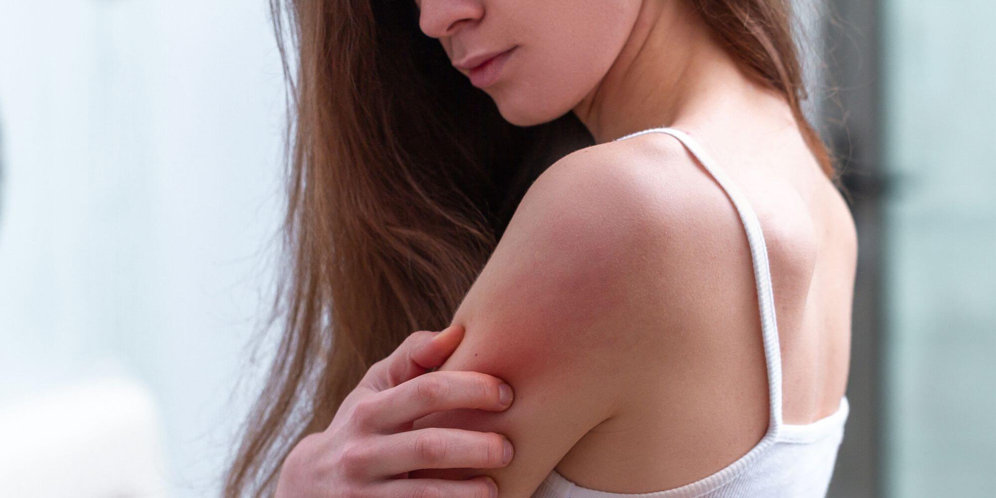 bouton de chaleur que faire ?