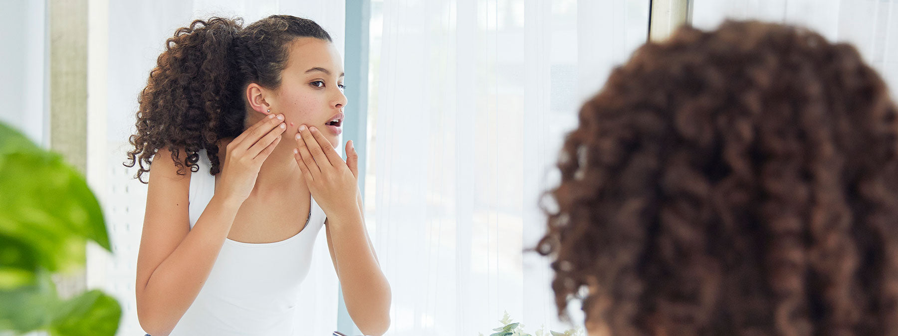 Reconnaître l'acné hormonale pour savoir la traiter efficacement