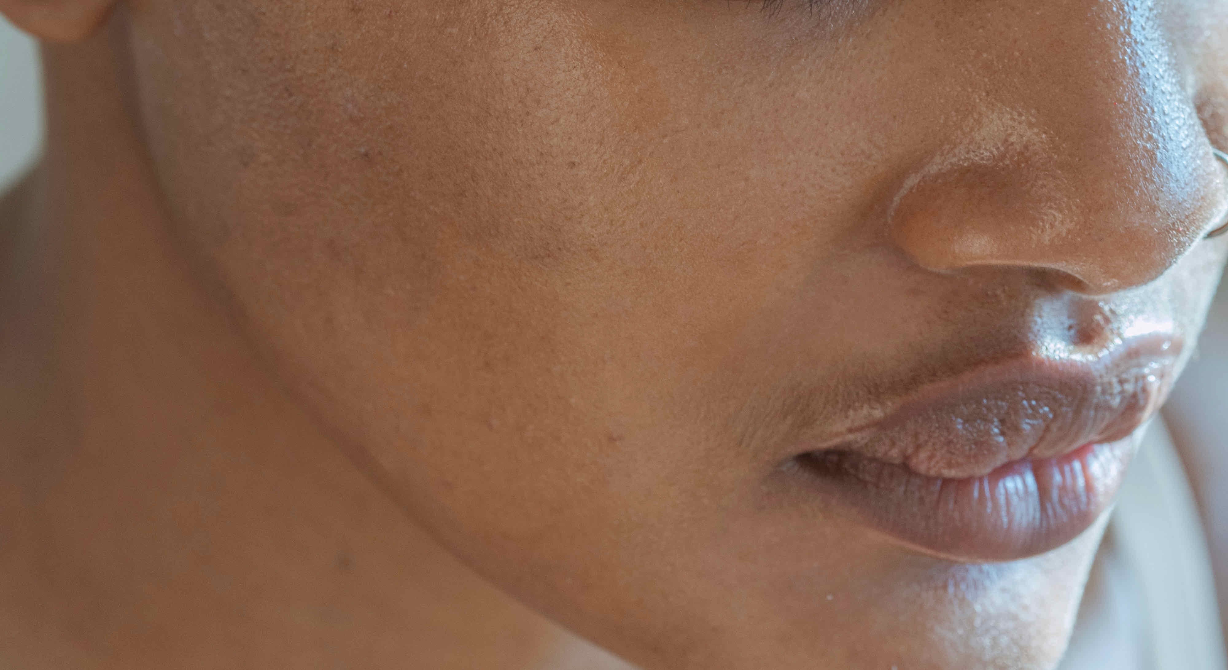 Peau grasse : 6 astuces qu'on aurait aimé connaître plus tôt !