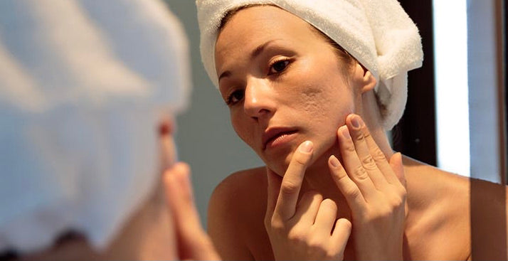Ces cicatrices sur mon visage que je ne peux plus voir dans le miroir...