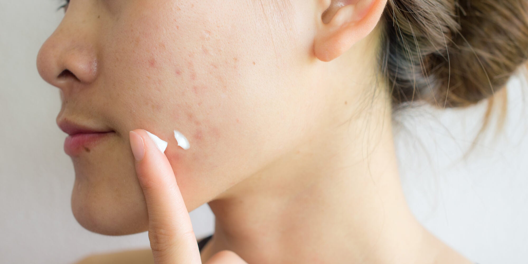 Mettre du dentifrice sur un bouton