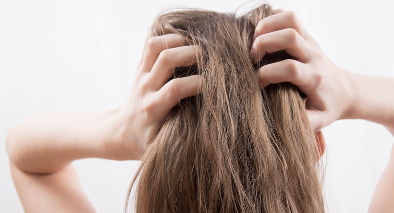 Psoriasis du cuir chevelu : comment soulager les crises ?