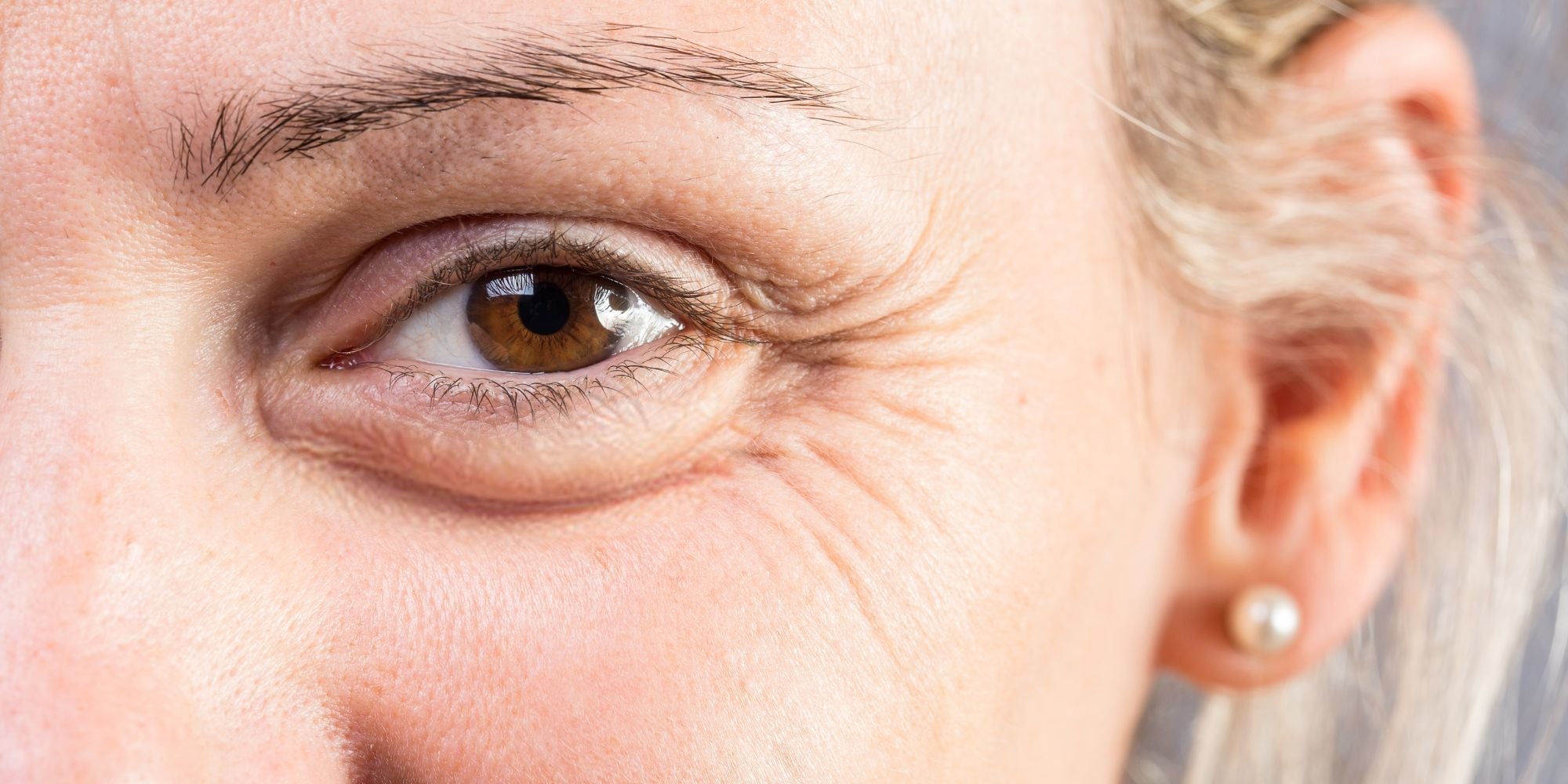 Femme avec rides sous les yeux