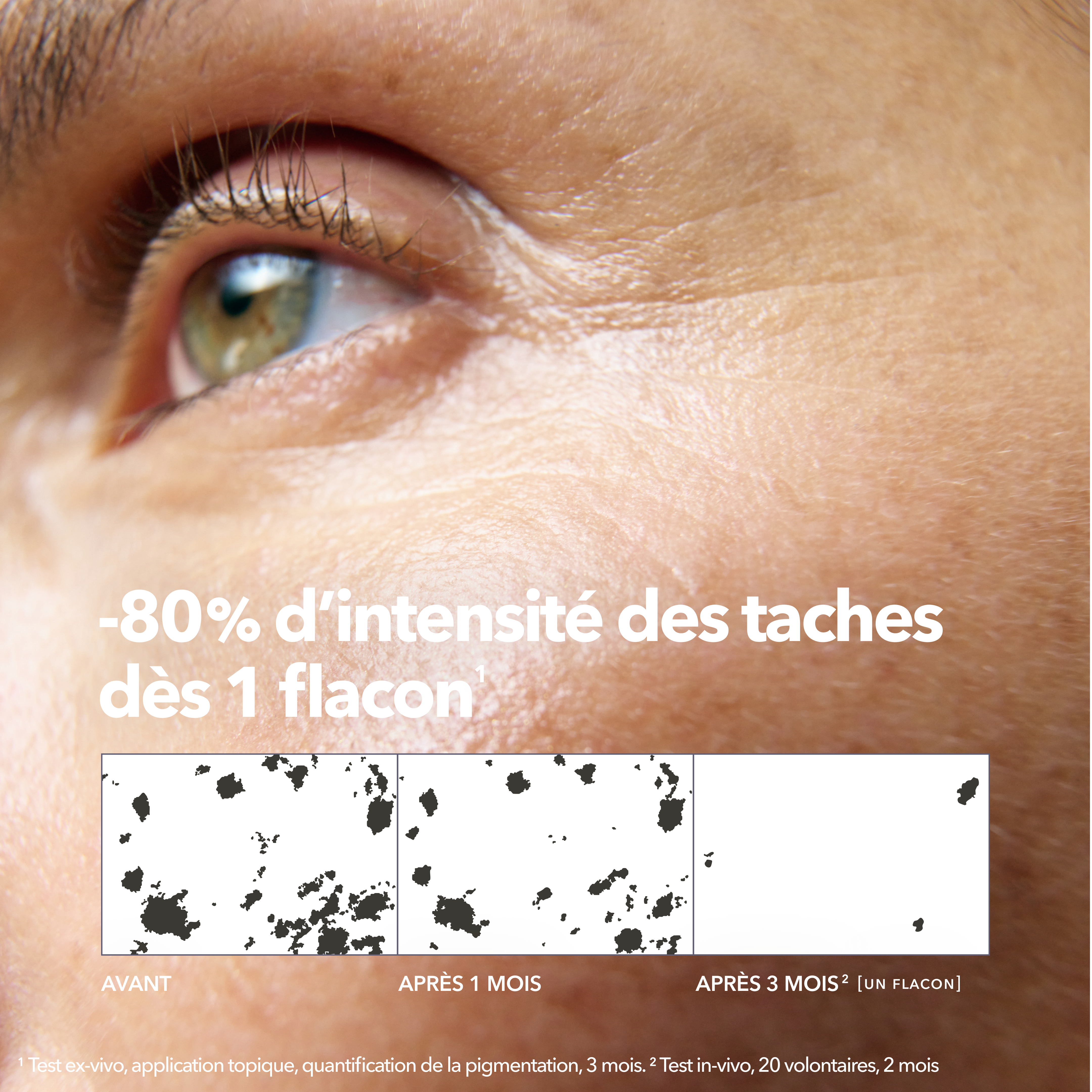Résultats Sérum Anti-Taches