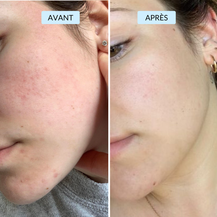 Célia, 22 ans