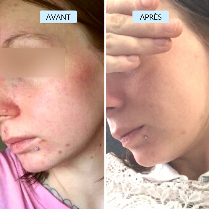 Alice, 28 ans