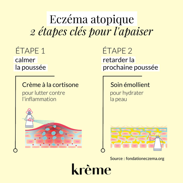 Apaiser eczéma