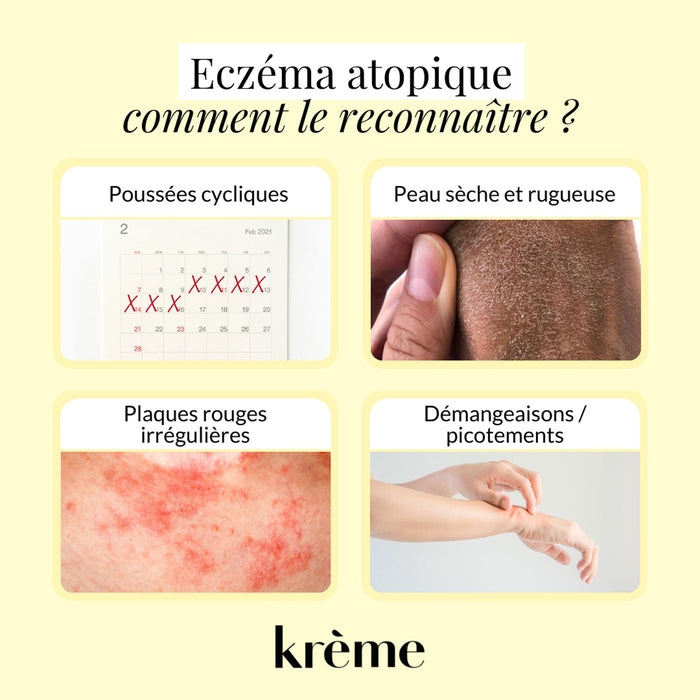 Reconnaître eczéma