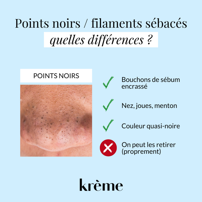 Comment se débarrasser des points noirs ?