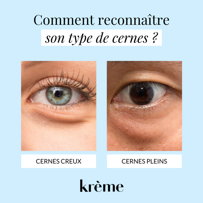 Cernes creux ou cernes pleins ?