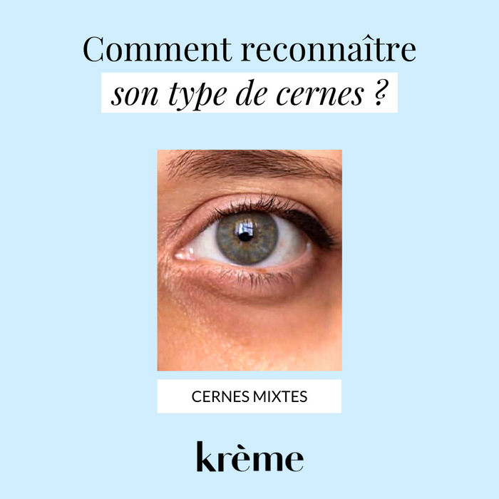 Comment reconnaître des cernes mixtes ?