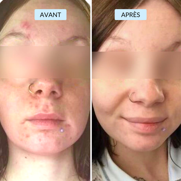 Alice, 28 ans