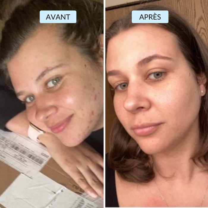 Inès, 32 ans