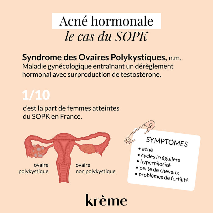 SOPK et acné hormonale