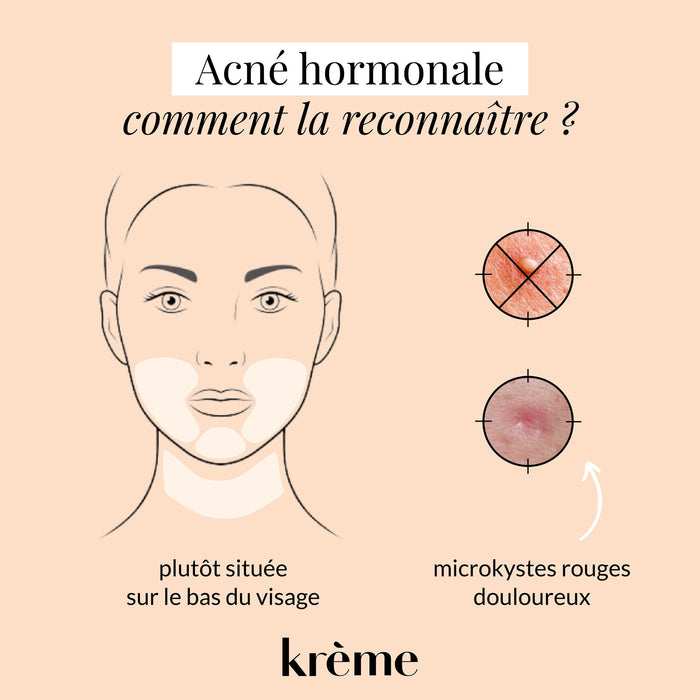 Reconnaître acné hormonale