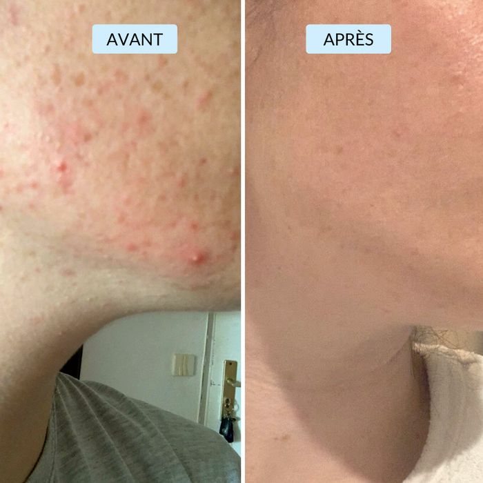 Chiara, 27 ans